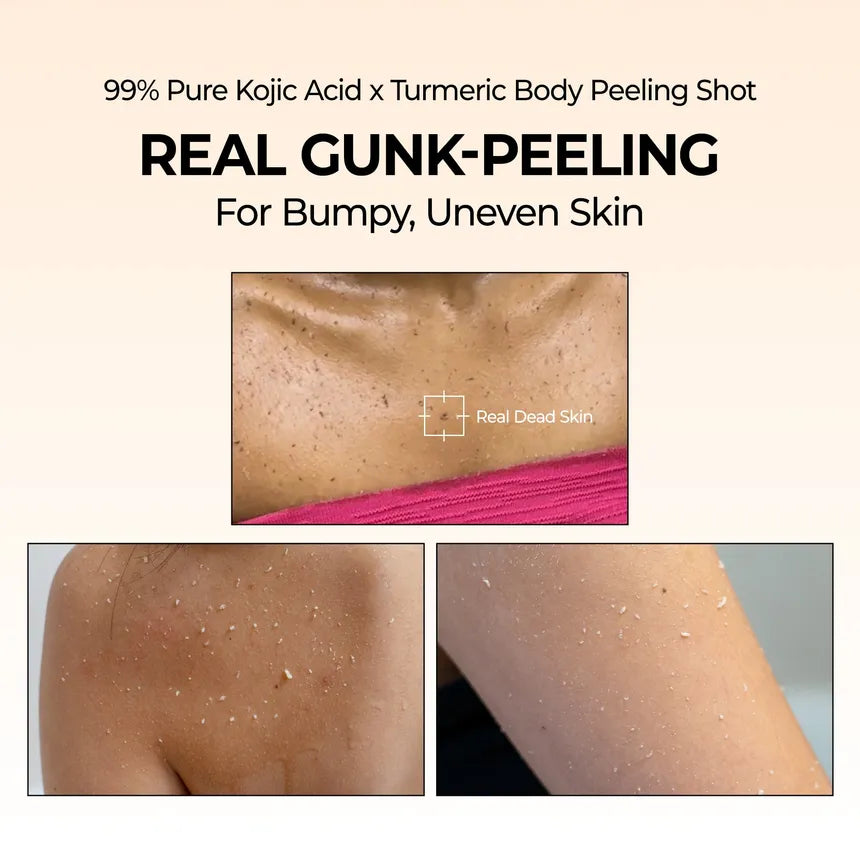 Dr.Melaxin Peel Shot Exfoliating Kojic Acid Turmeric Spray